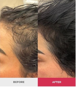 Before and After hair treatment